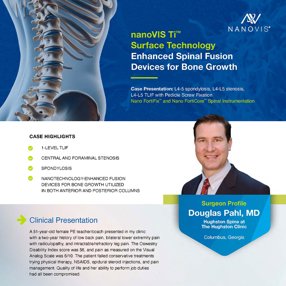 Enhanced Spinal Fusion Dr Pahl